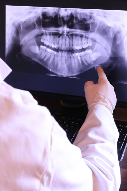 Best Broken or Chipped Tooth Repair in South San Gabriel, CA